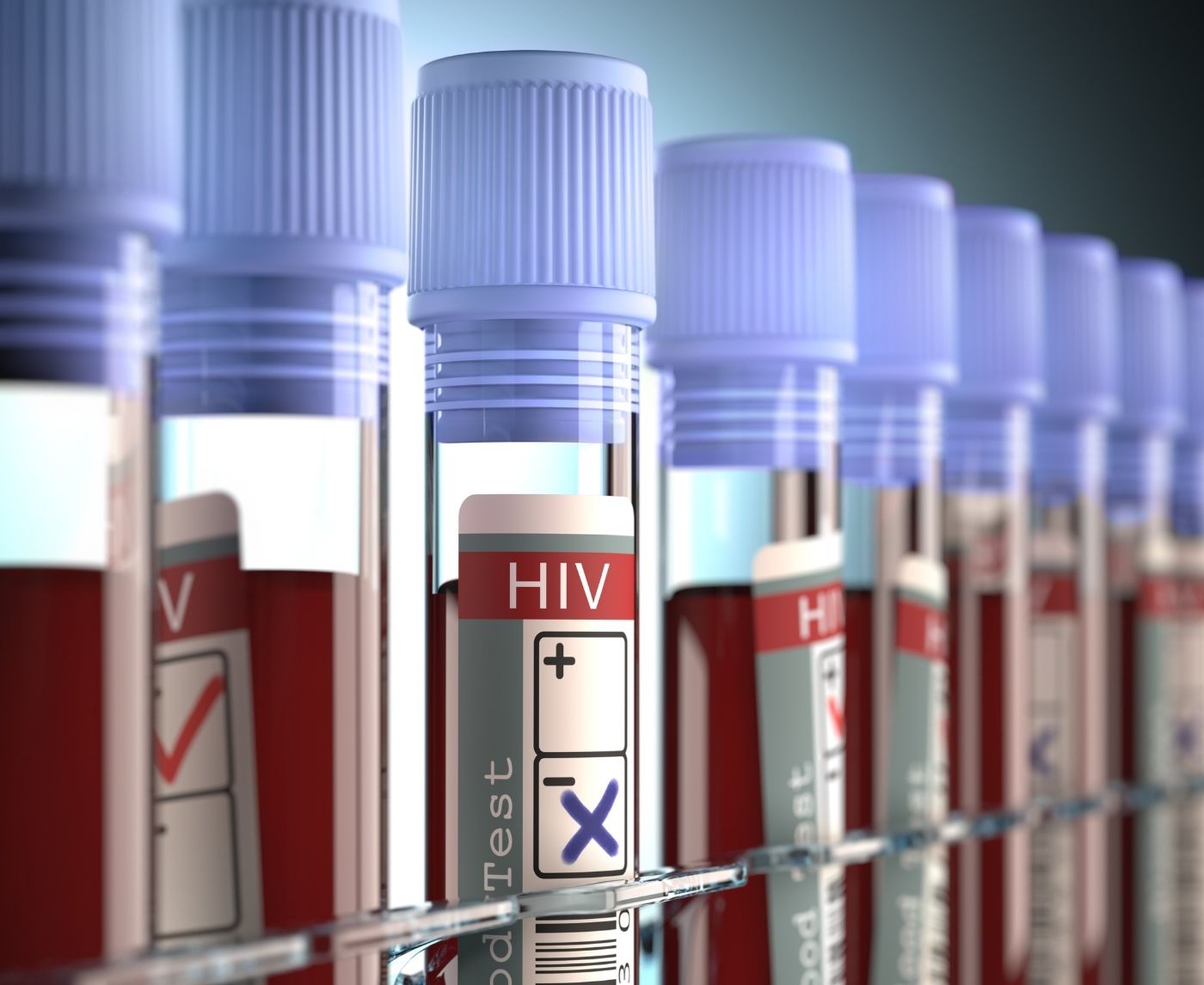 HIV Rapid Test vs Lab Test: What’s More Accurate and When?