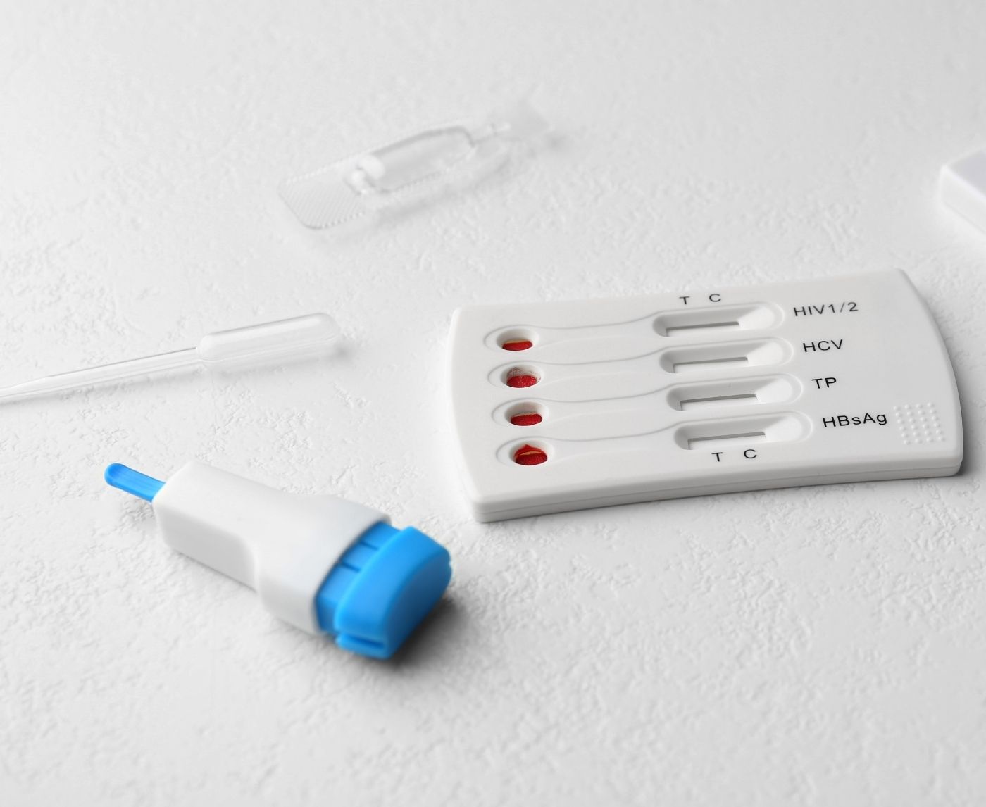 Tested Positive for Chlamydia: What Happens Next?