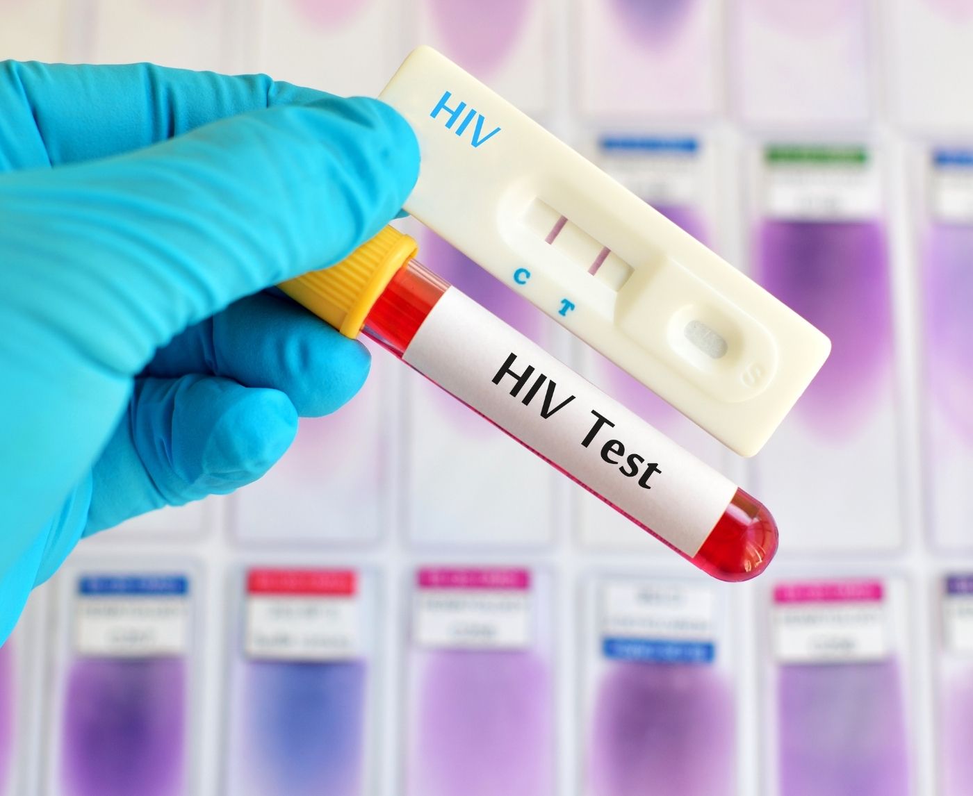HIV Test at 2 Weeks: Too Early or Good Enough?
