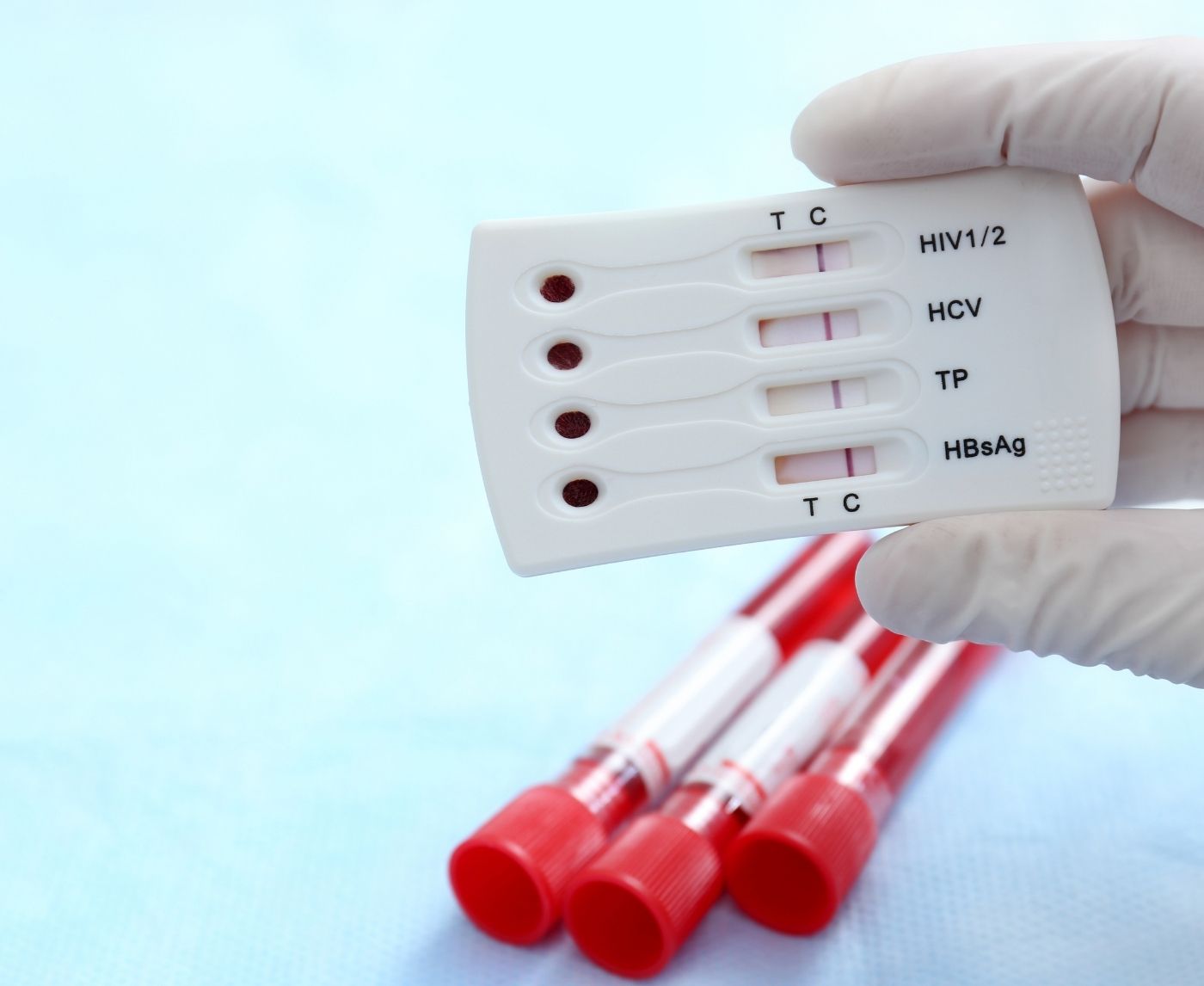 Faint Line on HIV Rapid Test? Here's How to Read It