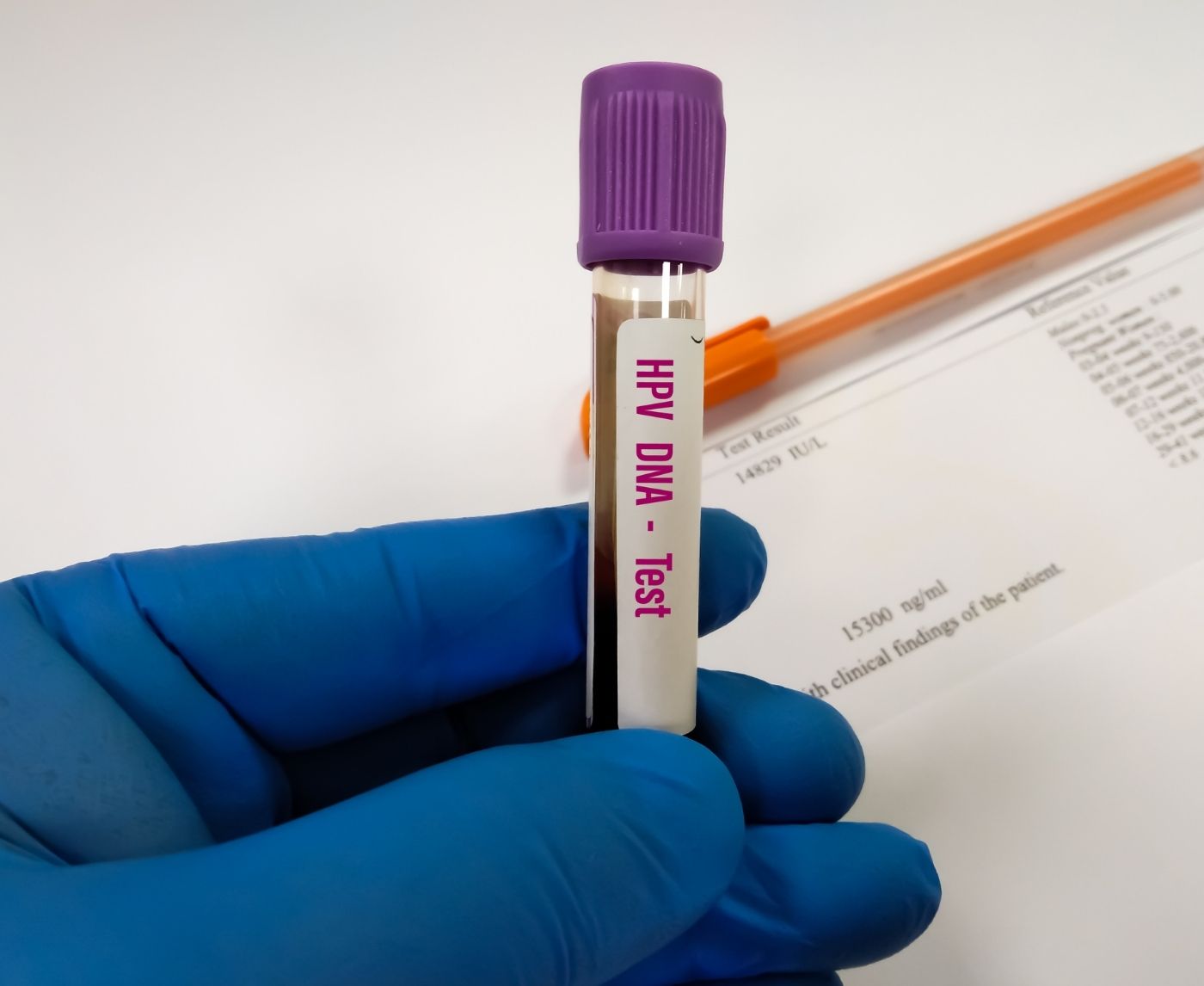 How Accurate Is the HPV Rapid Test? What Most People Get Wrong