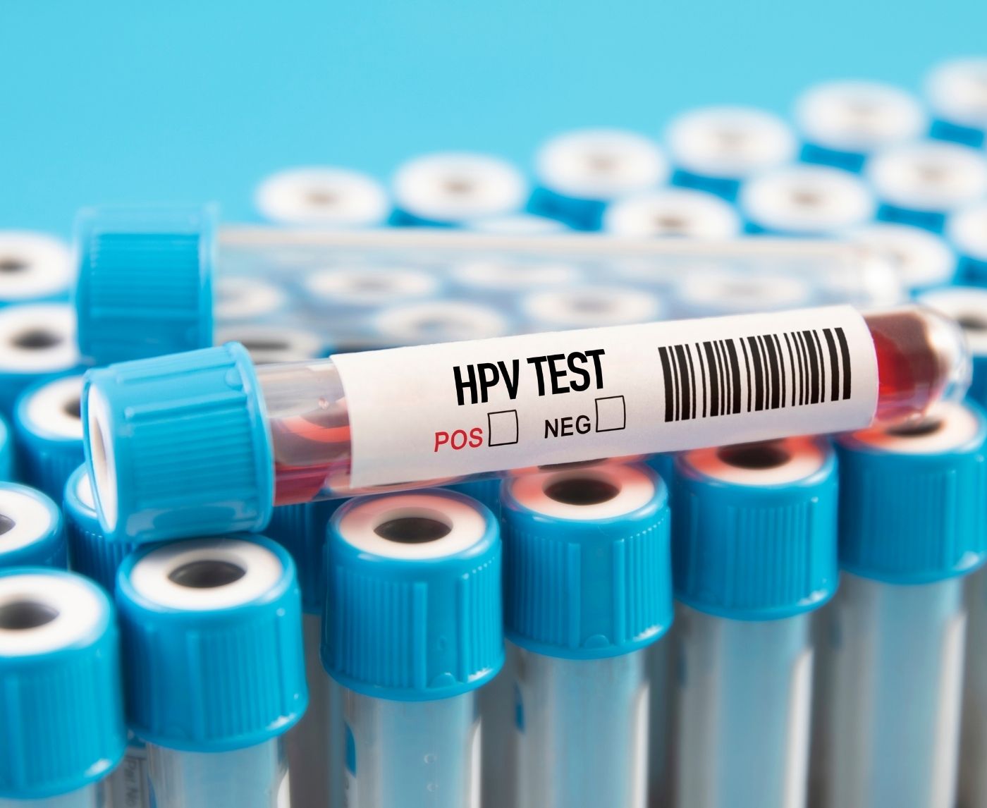 False Positives, Faint Lines, and Mistakes: The Truth About HPV Testing