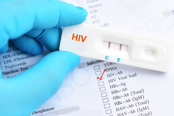 How Do At-Home STD Test Kits Work?