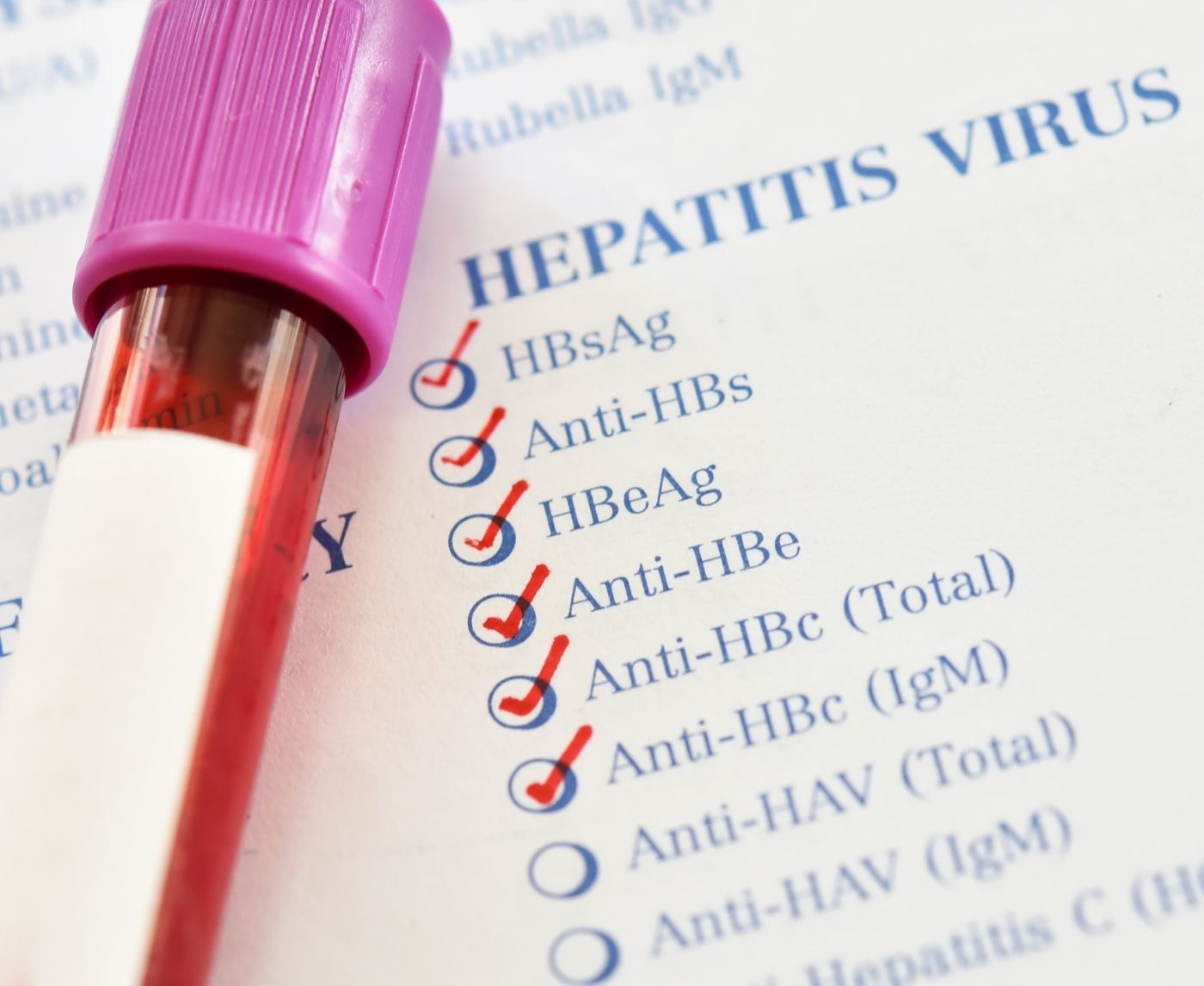 Hepatitis B Transmission: How Vaccination Makes a Difference