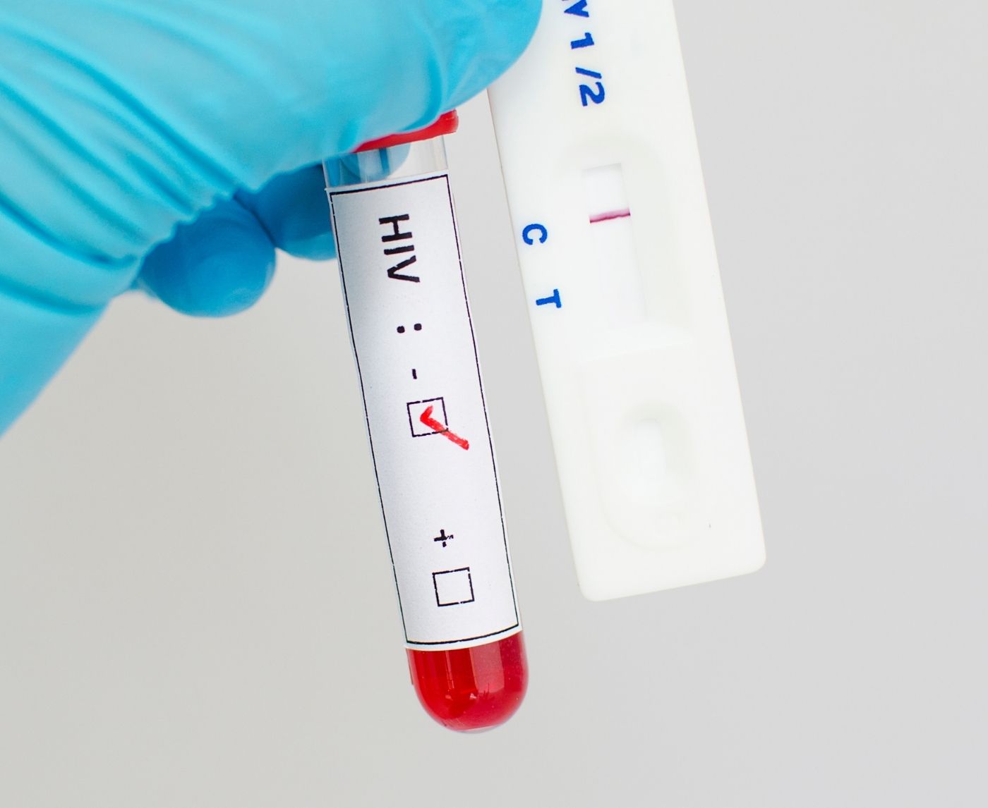 The Real Reason You Haven’t Gotten an STD Test (Yet)