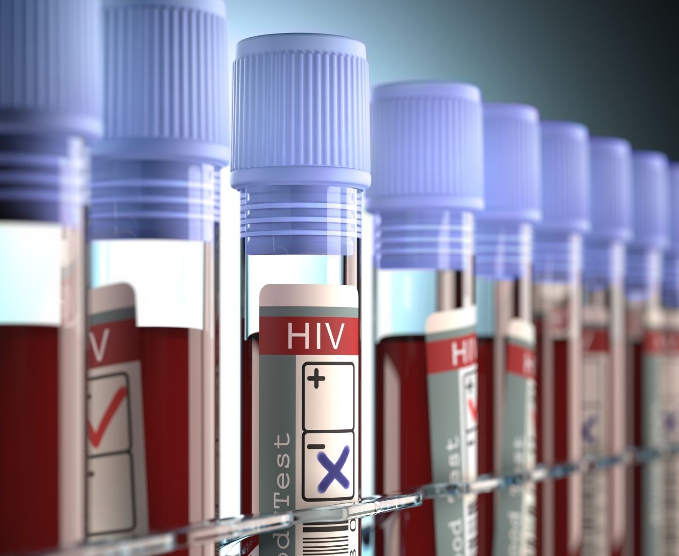 Can You Have an STD With a Negative Test? What You Need to Know