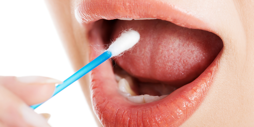 Will They Swab There? Inside the Awkward Truth About STD Testing