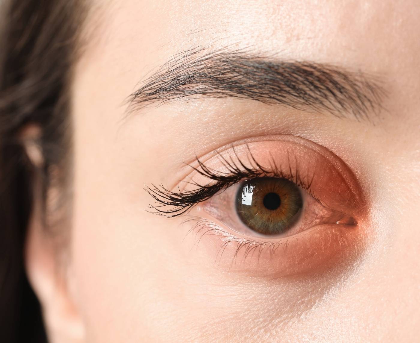 STD in the Eye: What to Know If You Have No Other Symptoms