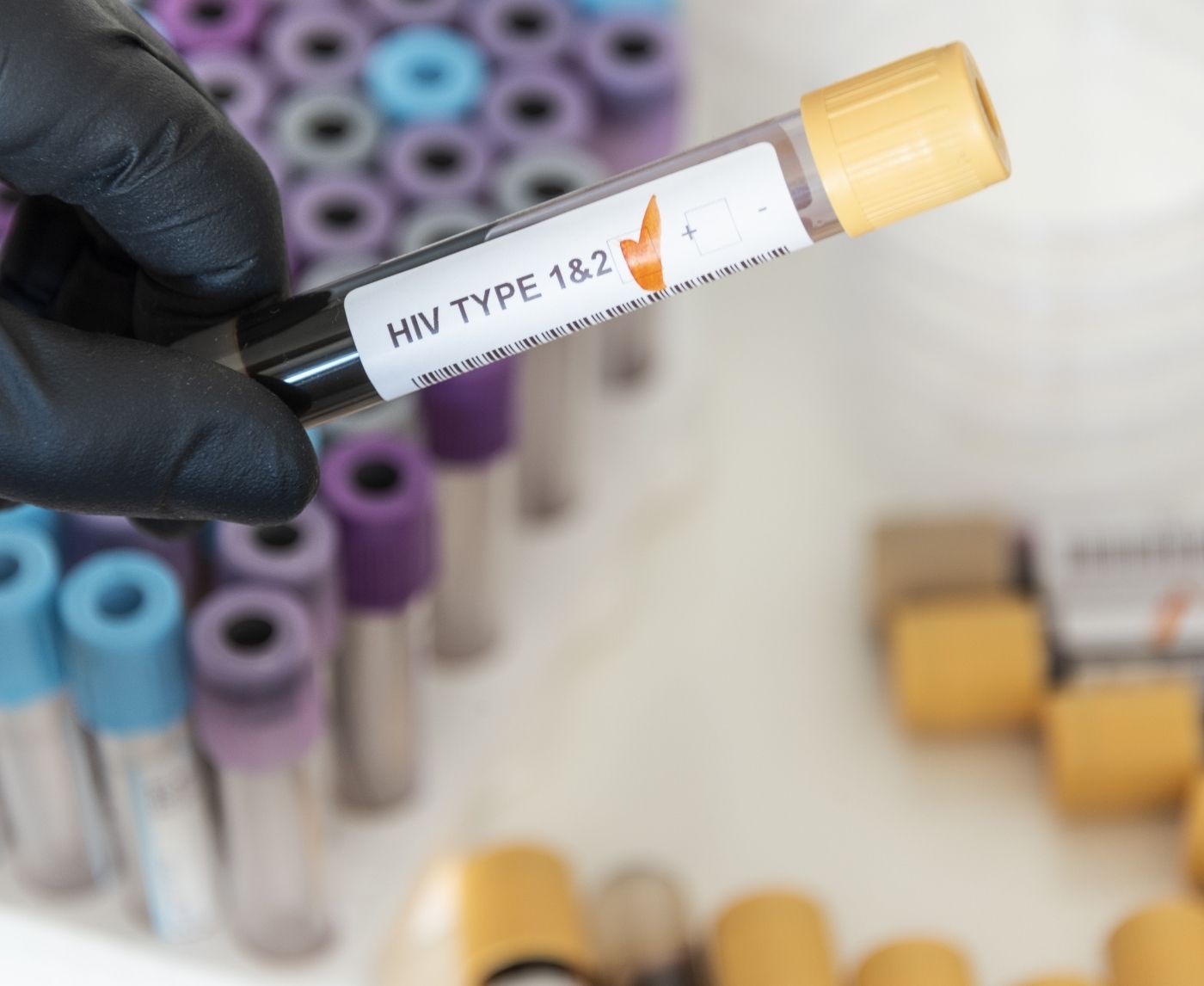 Still Testing Positive After Treatment? Here’s When to Retest