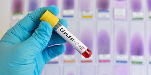 Screening for Chlamydia Infected Individuals