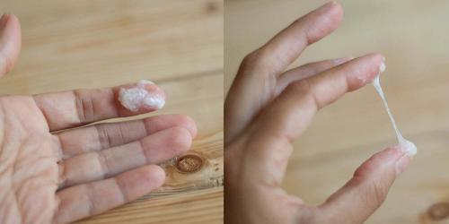 Causes and Prevention of Vaginal Discharge