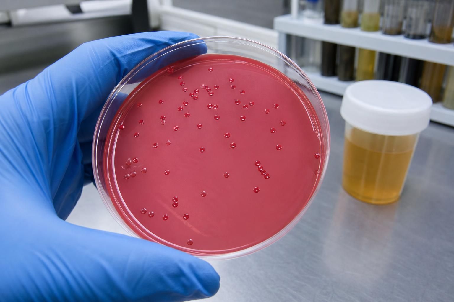 Gloved hand tilting a petri dish of red-pink agar covered with small, separate, translucent red colonies from a stool culture.