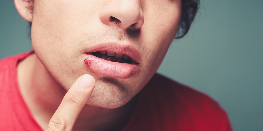 How to Have Sex Again After a Herpes or Chlamydia Diagnosis