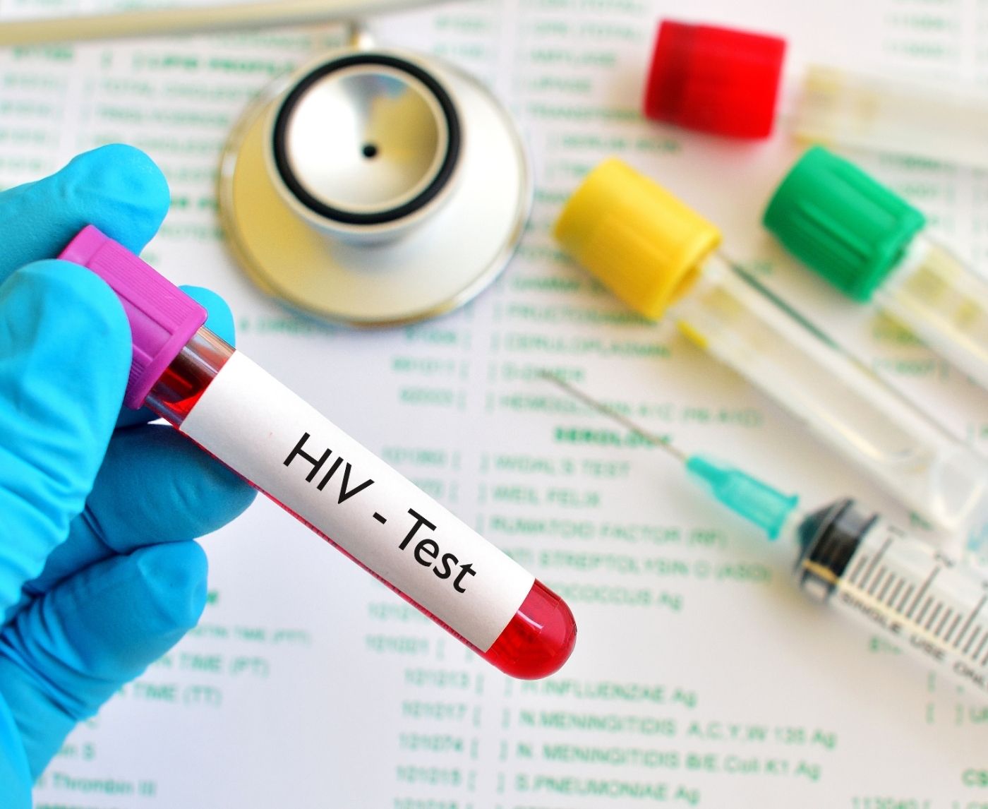 The Symptoms, Causes, and Treatment of an HIV Rash