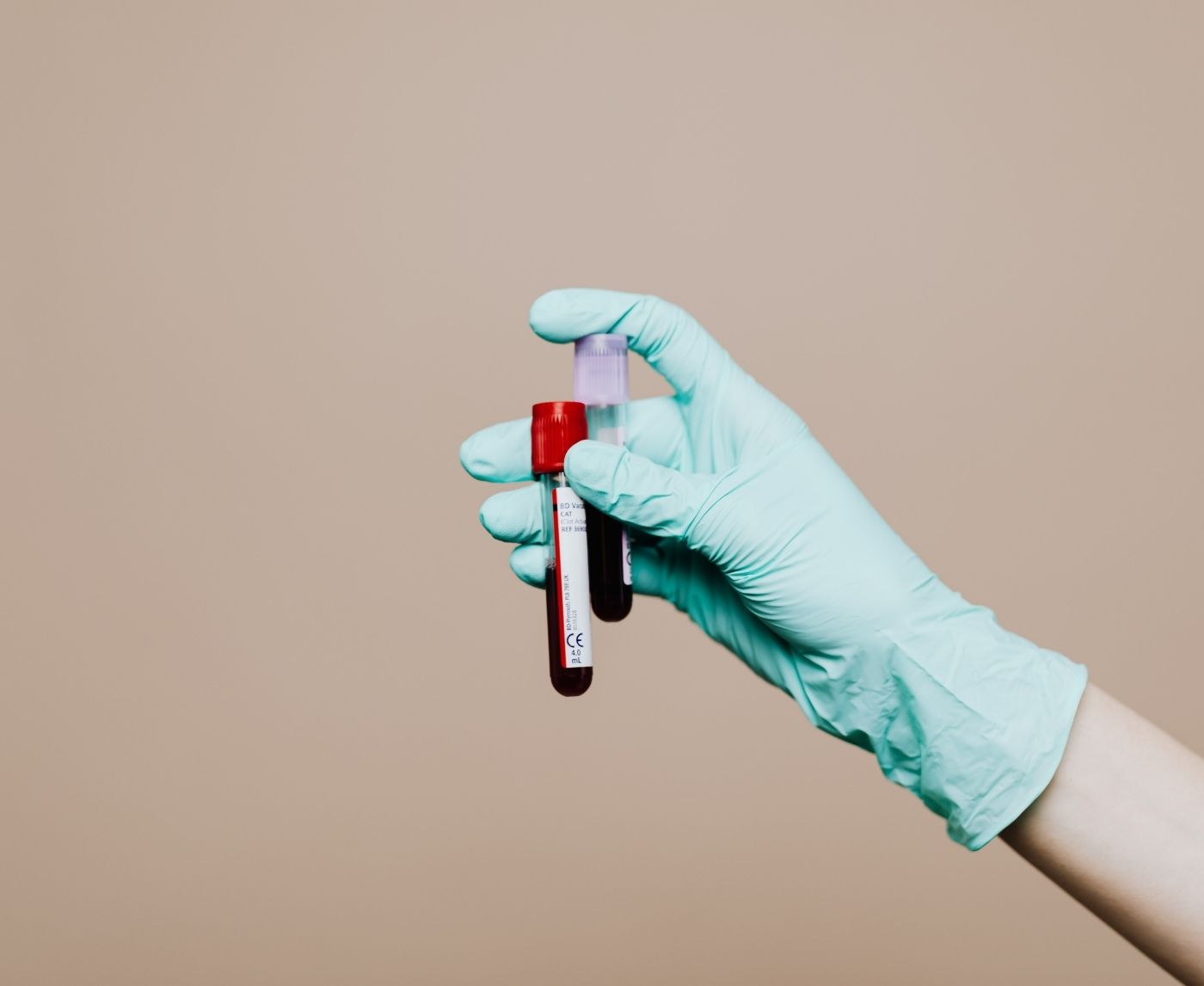 How Soon After Sex Can You Test for STDs? The Real Timeline