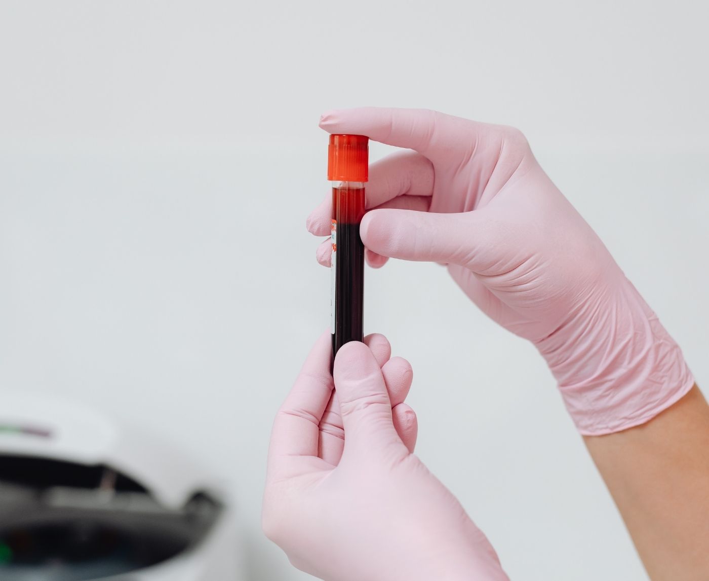 The STD You’ve Probably Never Been Tested For