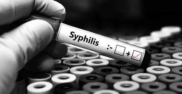 The Syphilis Surge No One Saw Coming