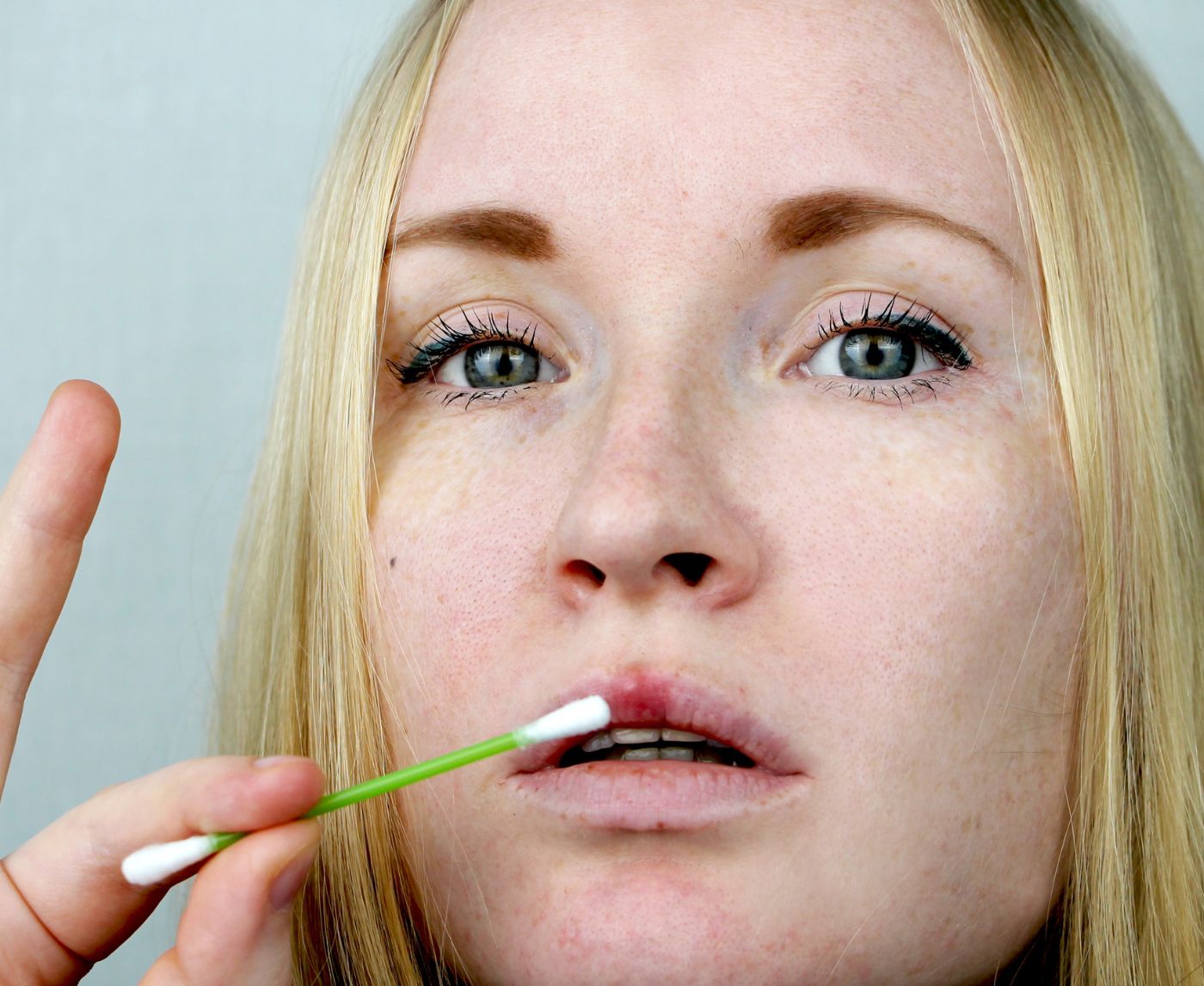 The Evolution of Home Syphilis Test Kits and Their Impact on Public Health