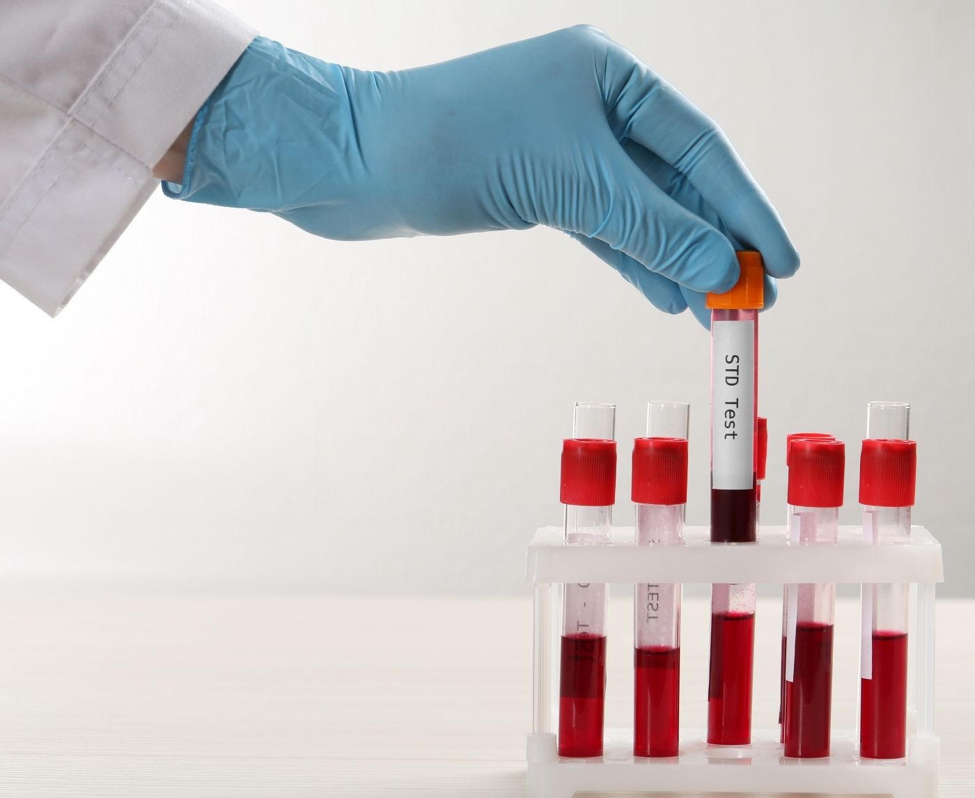 Think You Got a “Full” STD Panel? Hep B Is Usually Missing