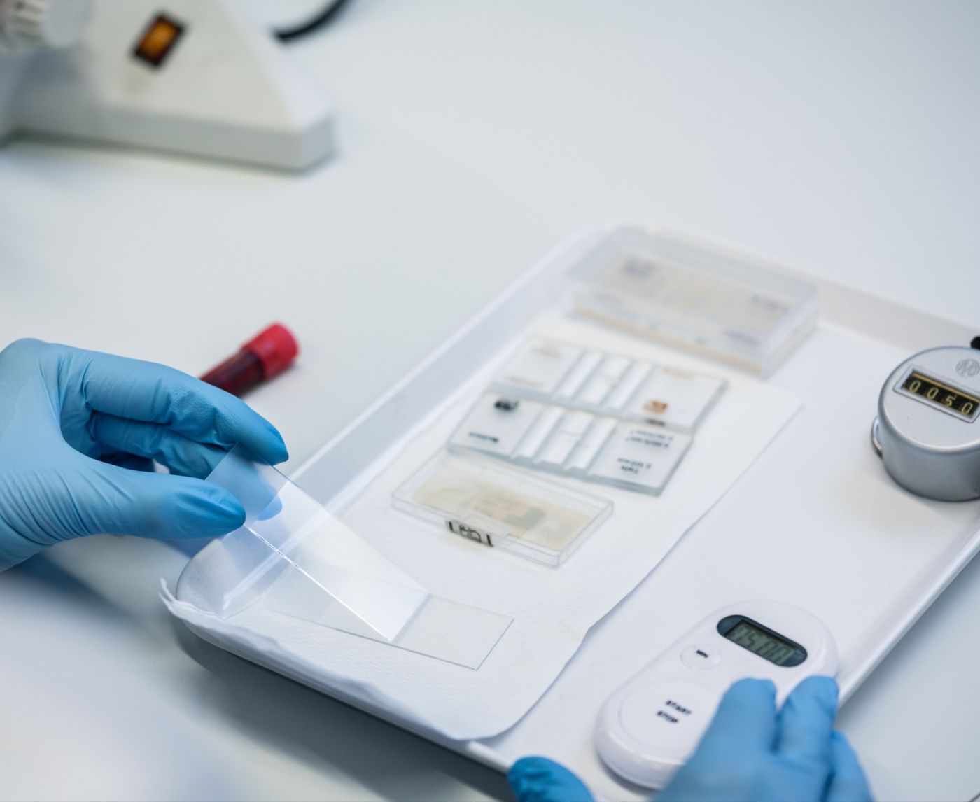 The Evolution of STD Testing: How Rapid Testing Leads the Way