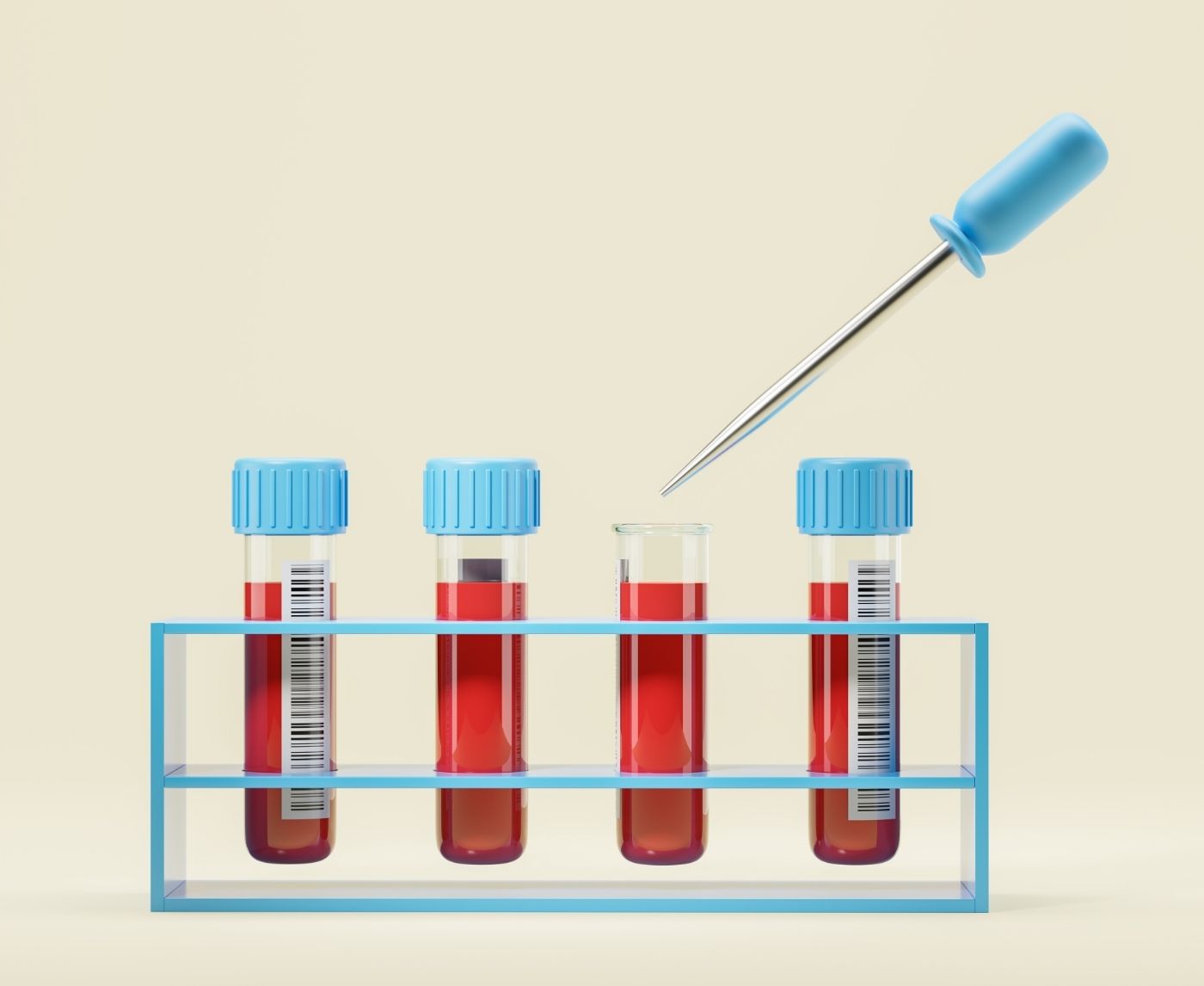 Unprotected Sex? Here's When to Get Tested for STDs