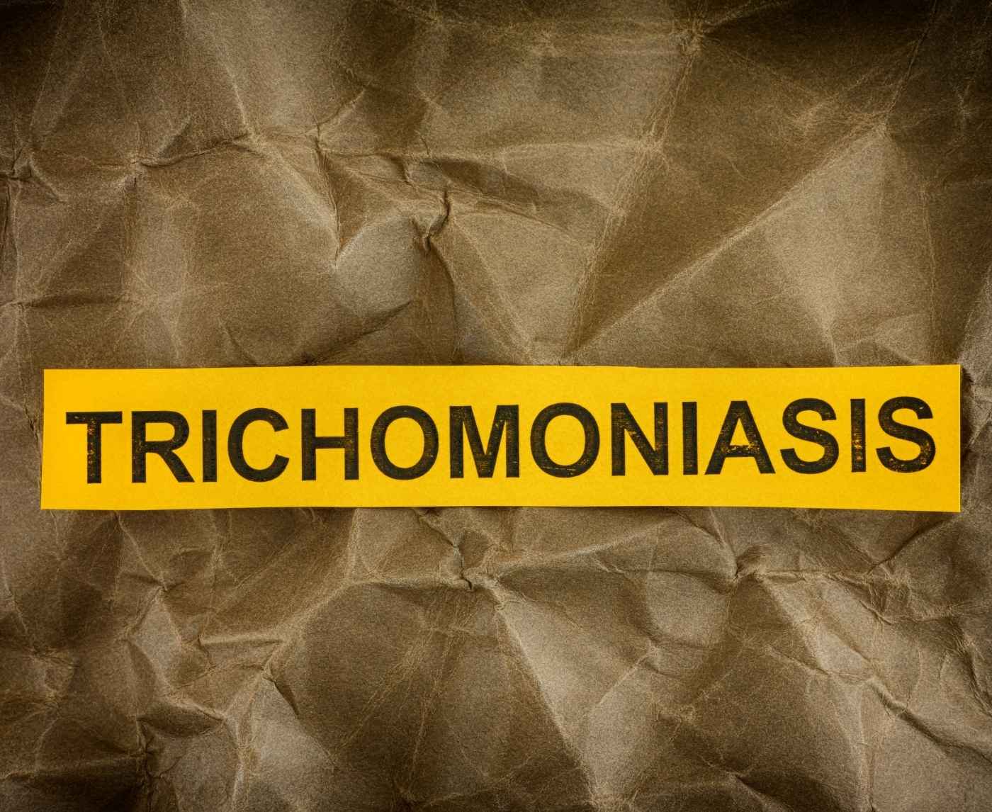 How to Avoid Trichomoniasis: Simple Prevention Strategies
