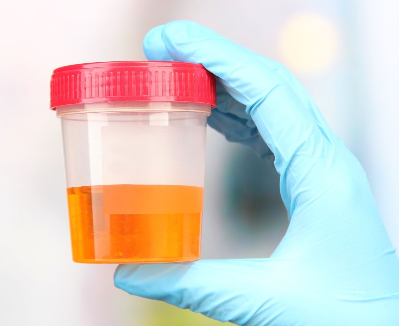 Swab or Pee? Choosing the Right Chlamydia Test