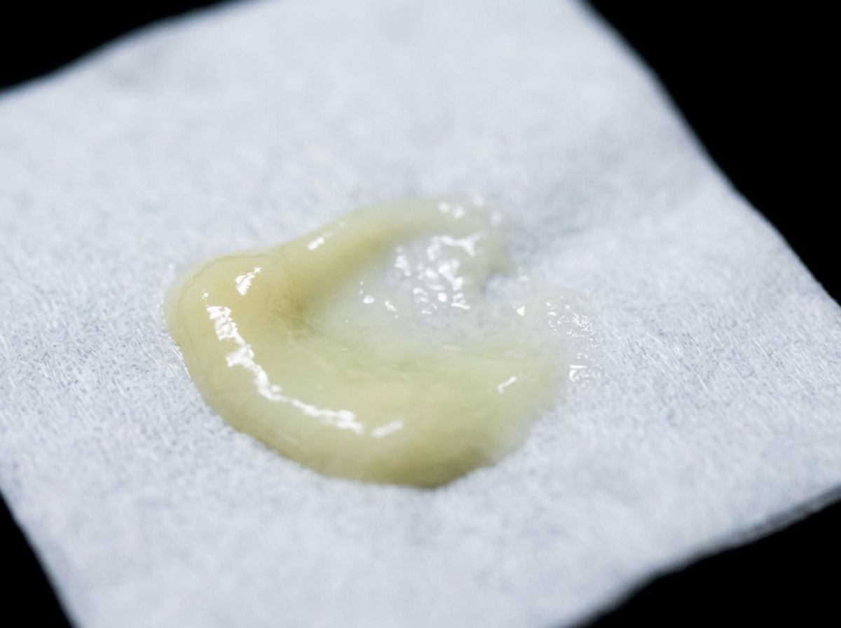 Is Discharge Without Pain a Sign of an STD?