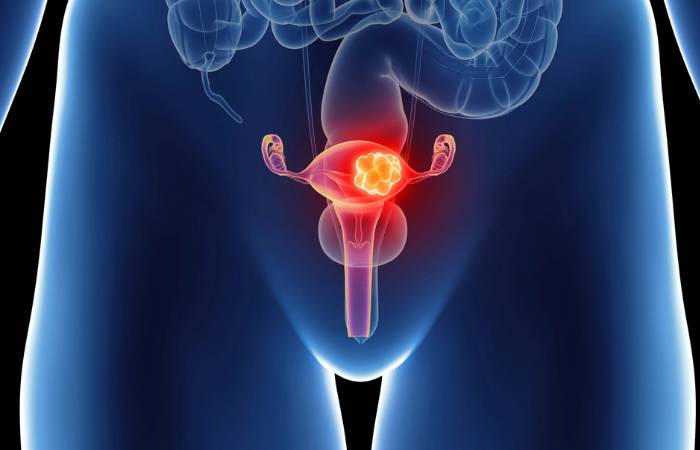 The anatomical model female reproductive organs in doctor palm hand on work desk